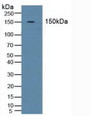 Western Blot; Sample: Human Blood Cells.