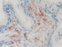 DAB staining on IHC-P; Samples: Human Prostate Tissue; Primary Ab: 10µg/ml Rabbit Anti-Human PRNP Antibody Second Ab: 2µg/mL HRP-Linked Caprine Anti-Rabbit IgG Polyclonal Antibody