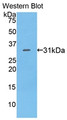 Western Blot; Sample: Recombinant protein.