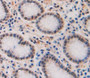 Used in DAB staining on fromalin fixed paraffin- embedded Kidney tissue