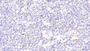 DAB staining on IHC-P; Samples: Human Colon Tissue; Primary Ab: 20μg/ml Rabbit Anti-Human PRKAb1 Antibody Second Ab: 2µg/mL HRP-Linked Caprine Anti-Rabbit IgG Polyclonal Antibody