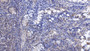 DAB staining on IHC-P; Samples: Human Small intestine Tissue;  Primary Ab: 20µg/ml Rabbit Anti-Human CD226 Antibody Second Ab: 2µg/mL HRP-Linked Caprine Anti-Rabbit IgG Polyclonal Antibody 