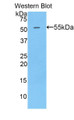 Western Blot; Sample: Recombinant protein.