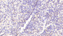 DAB staining on fromalin fixed paraffin-embedded Liver tissue)