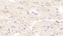 DAB staining on IHC-P; Samples: Human Cardiac Muscle Tissue; Primary Ab: 30µg/ml Rabbit Anti-Human TTN Antibody Second Ab: 2µg/mL HRP-Linked Caprine Anti-Rabbit IgG Polyclonal Antibody