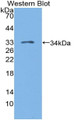 Western Blot; Sample: Recombinant LAG3, Human.