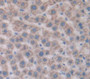 Solute Carrier Family 27 Member 5 (Slc27A5) Polyclonal Antibody, Cat#CAU25533