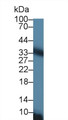 Western Blot; Sample: Rat Liver lysate; Primary Ab: 1µg/ml Rabbit Anti-Rat CACT Antibody Second Ab: 0.2µg/mL HRP-Linked Caprine Anti-Rabbit IgG Polyclonal Antibody