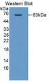 Western Blot; Sample: Recombinant protein.