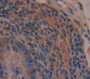 Trefoil Factor 3 (Tff3) Polyclonal Antibody, Cat#CAU25544