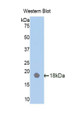 Western Blot; Sample: Recombinant protein.