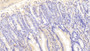 DAB staining on IHC-P; Samples: Mouse Colon Tissue; Primary Ab: 20μg/ml Rabbit Anti-Mouse IL18RAP Antibody Second Ab: 2µg/mL HRP-Linked Caprine Anti-Rabbit IgG Polyclonal Antibody