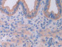 DAB staining on IHC-P; Samples: Mouse Uterus Tissue; Primary Ab: 30µg/ml Rabbit Anti-Mouse IL18RAP Antibody Second Ab: 2µg/mL HRP-Linked Caprine Anti-Rabbit IgG Polyclonal Antibody