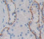 Interleukin-18 Receptor Beta (Il18R Beta) Polyclonal Antibody, Cat#CAU25551