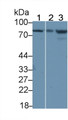 Western Blot; Sample: Lane1: Mouse Cerebrum lysate; Lane2: A549 cell lysate; Lane3: PANC1 cell lysate; Primary Ab: 3μg/ml Rabbit Anti-Human IL18R1 Antibody; Second Ab: 0.2µg/mL HRP-Linked Caprine Anti-Rabbit IgG Polyclonal Antibody;