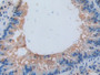 DAB staining on IHC-P; Samples: Mouse Lung Tissue; Primary Ab: 10µg/ml Rabbit Anti-Mouse IL17RA Antibody Second Ab: 2µg/mL HRP-Linked Caprine Anti-Rabbit IgG Polyclonal Antibody