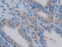 DAB staining on fromalin fixed paraffin- embedded lung tissue)