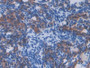 DAB staining on IHC-P; Samples: Mouse Ovary Tissue; Primary Ab: 30µg/ml Rabbit Anti-Mouse IL13Ra2 Antibody Second Ab: 2µg/mL HRP-Linked Caprine Anti-Rabbit IgG Polyclonal Antibody