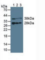 Western Blot; Sample: Lane1: Porcine Liver Tissue; Lane2: Porcine Heart Tissue; Lane3: Porcine Skeletal Muscle Tissue.