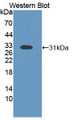 Western Blot; Sample: Recombinant ETFb, Human.