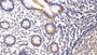 DAB staining on IHC-P; Sample: Human Rectum Tissue; Primary Ab: 20ug/ml Rabbit Anti-Human IL12Rb1 Antibody Second Ab: 2µg/mL HRP-Linked Caprine Anti-Rabbit IgG Polyclonal Antibody