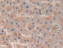 DAB staining on IHC-P; Samples: Human Liver Tissue; Primary Ab: 10µg/ml Rabbit Anti-Human MAPKAPK3 Antibody Second Ab: 2µg/mL HRP-Linked Caprine Anti-Rabbit IgG Polyclonal Antibody