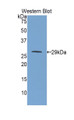 Western Blot; Sample: Recombinant protein.