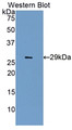 Western Blot; Sample: Recombinant protein.