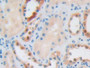 DAB staining on IHC-P; Samples: Human Kidney Tissue;  Primary Ab: 10µg/ml Rabbit Anti-Human IGF2R An