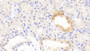 DAB staining on IHC-P; Samples: Human Kidney Tissue;  Primary Ab: 20μg/ml Rabbit Anti-Human KCC3 Antibody Second Ab: 2µg/mL HRP-Linked Caprine Anti-Rabbit IgG Polyclonal Antibody 