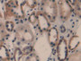 DAB staining on IHC-P; Samples: Human Kidney Tissue; Primary Ab: 10µg/ml Rabbit Anti-Human cPLA2 Antibody Second Ab: 2µg/mL HRP-Linked Caprine Anti-Rabbit IgG Polyclonal Antibody