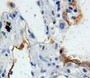 Used in DAB staining on fromalin fixed paraffin-embedded lung tissue