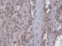 DAB staining on IHC-P; Samples: Human Prostate Tissue;  Primary Ab: 20µg/ml Rabbit Anti-Human SRP9 A