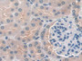 DAB staining on IHC-P; Samples: Mouse Kidney Tissue; Primary Ab: 20µg/ml Rabbit Anti-Mouse CLEC4L Antibody Second Ab: 2µg/mL HRP-Linked Caprine Anti-Rabbit IgG Polyclonal Antibody
