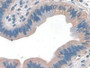 DAB staining on fromalin fixed paraffin- embedded Kidney tissue)