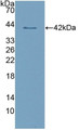 Western Blot; Sample: Recombinant CLEC4L, Human.