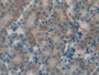 DAB staining on IHC-P; Samples: Mouse Kidney Tissue;  Primary Ab: 20µg/ml Rabbit Anti-Mouse CGa Anti