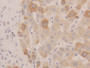 DAB staining on IHC-P; Samples: Human Liver Tissue)