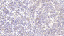 DAB staining on IHC-P; Samples: Human Spleen Tissue; Primary Ab: 20μg/ml Rabbit Anti-Human LAMP3 Antibody Second Ab: 2µg/mL HRP-Linked Caprine Anti-Rabbit IgG Polyclonal Antibody