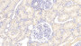 DAB staining on fromalin fixed paraffin- embedded Kidney tissue)