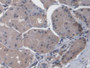 DAB staining on IHC-P; Samples: Human Stomach Tissue; Primary Ab: 20µg/ml Rabbit Anti-Human BRAK Antibody Second Ab: 2µg/mL HRP-Linked Caprine Anti-Rabbit IgG Polyclonal Antibody