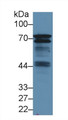 Western Blot; Sample: Mouse Spleen lysate; Primary Ab: 1.5µg/ml Rabbit Anti-Human BLNK Antibody Second Ab: 0.2µg/mL HRP-Linked Caprine Anti-Rabbit IgG Polyclonal Antibody