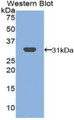 Western Blot; Sample: Recombinant protein.