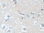 DAB staining on IHC-P; Samples: Human Cerebrum Tissue;  Primary Ab: 20µg/ml Rabbit Anti-Human PLCb1