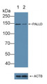 Knockout Varification: ; Lane 1: Wild-type Hela cell lysate; ; Lane 2: PALLD knockout Hela cell lysate; ; Predicted MW: 151,122~127,108kd ; Observed MW: 145kd; Primary Ab: 1µg/ml Rabbit Anti-Human PALLD Antibody; Second Ab: 0.2µg/mL HRP-Linked Caprine Anti-Rabbit IgG Polyclonal Antibody;