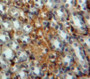 DAB staining on fromalin fixed paraffin-embedded Kidney tissue)