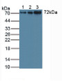 Figure. Western Blot; Sample: Lane1: Human Jurkat Cells; Lane2: Human PC-3 Cells; Lane3: Human Raji Cells.