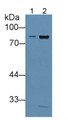 Western Blot; Sample: Lane1: Mouse Lymph node lysate; Lane2: Mouse Spleen lysate; Primary Ab: 2µg/mL Rabbit Anti-Mouse ITGb2 Antibody; Second Ab: 0.2µg/mL HRP-Linked Caprine Anti-Rabbit IgG Polyclonal Antibody;