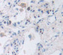 Integrin Beta 2 (Cd18) Polyclonal Antibody, Cat#CAU25674