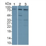 Western Blot; Sample: Lane1: Human Lung lysate; Lane2: A549 cell lysate; Lane3: Jurkat cell lysate&lt;br/&gt;Primary Ab: 2µg/ml Rabbit Anti-Human ITGb2 Antibody&lt;br/&gt;Second Ab: 0.2µg/mL HRP-Linked Caprine Anti-Rabbit IgG Polyclonal Antibody&lt;br/&gt;